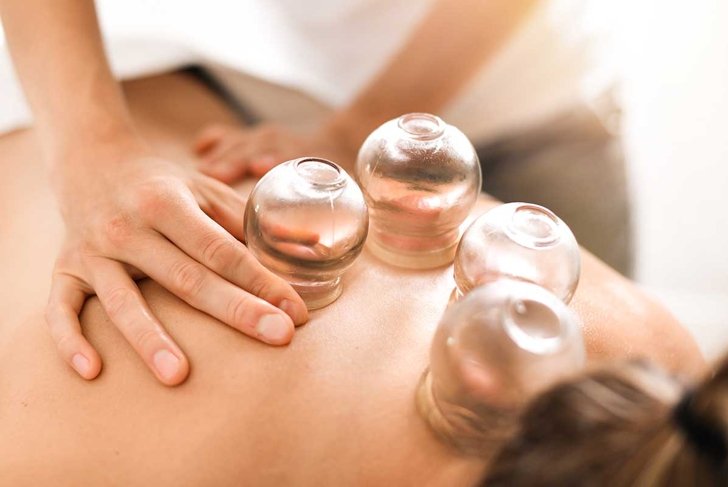 Detail of a woman therapist hands giving cupping treatment on back.